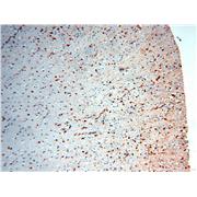 MT3 Rabbit Polyclonal Antibody (12179-1-AP)