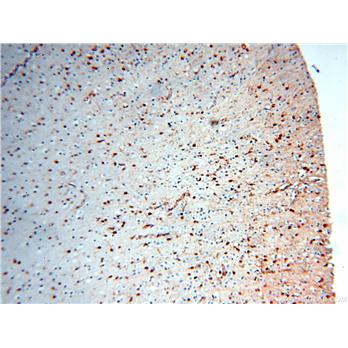MT3 Rabbit Polyclonal Antibody (12179-1-AP)