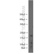 TSC22D3 Rabbit Polyclonal Antibody (12352-1-AP)