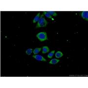 MAGEH1 Rabbit Polyclonal Antibody (12424-1-AP)