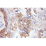 DPEP1 Rabbit Polyclonal Antibody (12222-1-AP)