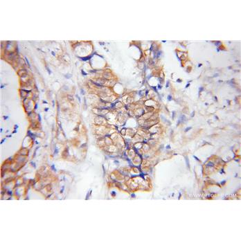 DPEP1 Rabbit Polyclonal Antibody (12222-1-AP)