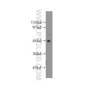 VPS45 Rabbit Polyclonal Antibody (12616-1-AP)
