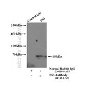 TP63 Rabbit Polyclonal Antibody (12143-1-AP)