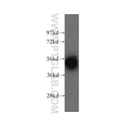 DBT Rabbit Polyclonal Antibody (12451-1-AP)