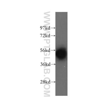 DBT Rabbit Polyclonal Antibody (12451-1-AP)