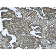C1QTNF1 Rabbit Polyclonal Antibody (12209-1-AP)