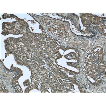 C1QTNF1 Rabbit Polyclonal Antibody (12209-1-AP)