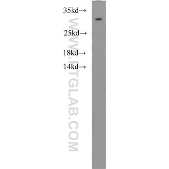MED8 Rabbit Polyclonal Antibody (12182-1-AP)