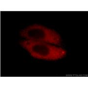 IL5RA Rabbit Polyclonal Antibody (12655-1-AP)