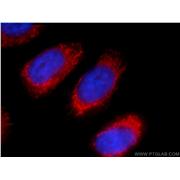 ACAA1 Rabbit Polyclonal Antibody (12319-2-AP)
