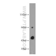 TCN2 Rabbit Polyclonal Antibody (12157-1-AP)