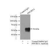 PPP2R5A Rabbit Polyclonal Antibody (12675-2-AP)