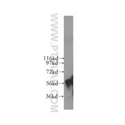 CYP4F11 Rabbit Polyclonal Antibody (12286-1-AP)