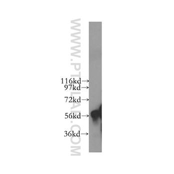 CYP4F11 Rabbit Polyclonal Antibody (12286-1-AP)