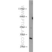 UCK1 Rabbit Polyclonal Antibody (12271-1-AP)