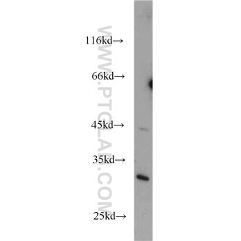 UCK1 Rabbit Polyclonal Antibody (12271-1-AP)