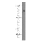 SGEF Rabbit Polyclonal Antibody (12493-1-AP)