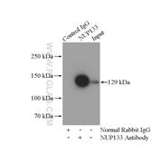 NUP133 Rabbit Polyclonal Antibody (12405-1-AP)