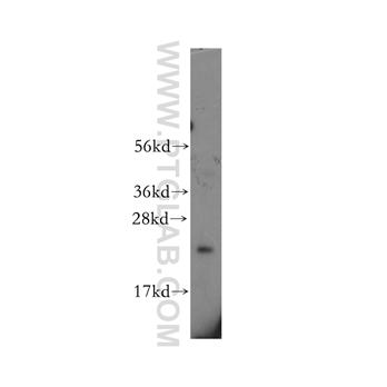 EDN1 Rabbit Polyclonal Antibody (12191-1-AP)