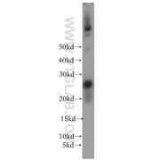 OIP5 Rabbit Polyclonal Antibody (12142-1-AP)