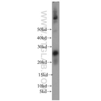 OIP5 Rabbit Polyclonal Antibody (12142-1-AP)