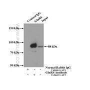 QARS Rabbit Polyclonal Antibody (12645-1-AP)