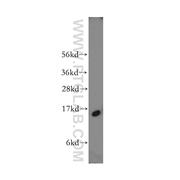 FABP5 Rabbit Polyclonal Antibody (12348-1-AP)