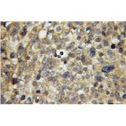 APPL1 Rabbit Polyclonal Antibody (12639-1-AP)