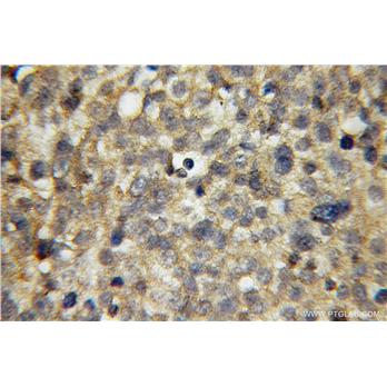 APPL1 Rabbit Polyclonal Antibody (12639-1-AP)