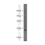 FXYD5 Rabbit Polyclonal Antibody (12166-1-AP)