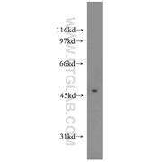PIP4K2A Rabbit Polyclonal Antibody (12469-1-AP)