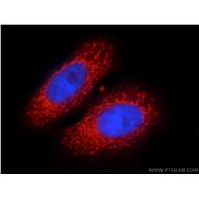 PHB2 Rabbit Polyclonal Antibody (12295-1-AP)