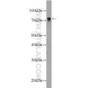 LIMK2 Rabbit Polyclonal Antibody (12350-1-AP)
