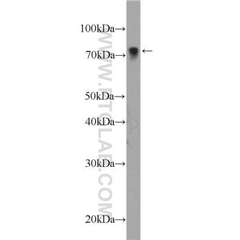 LIMK2 Rabbit Polyclonal Antibody (12350-1-AP)