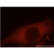 CCT8 Rabbit Polyclonal Antibody (12263-1-AP)