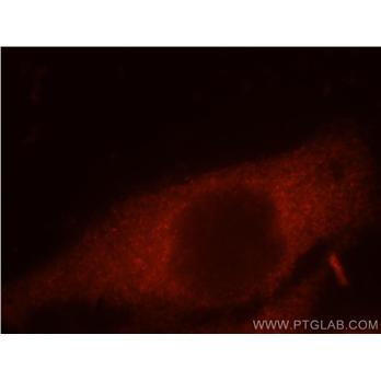 CCT8 Rabbit Polyclonal Antibody (12263-1-AP)