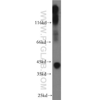 KCNJ10 Rabbit Polyclonal Antibody (12503-1-AP)