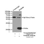 RAB39B Rabbit Polyclonal Antibody (12162-1-AP)