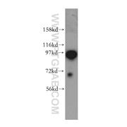 COPG Rabbit Polyclonal Antibody (12393-1-AP)