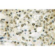 THAP1 Rabbit Polyclonal Antibody (12584-1-AP)