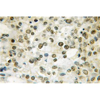 THAP1 Rabbit Polyclonal Antibody (12584-1-AP)