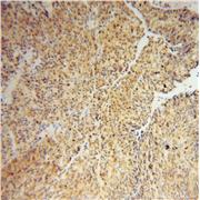 IRF2 Rabbit Polyclonal Antibody (12525-1-AP)