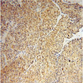 IRF2 Rabbit Polyclonal Antibody (12525-1-AP)