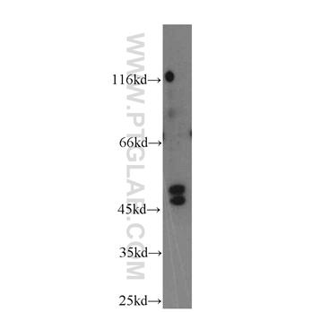 TRIM31 Rabbit Polyclonal Antibody (12543-1-AP)