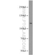 NCKAP1 Rabbit Polyclonal Antibody (12140-1-AP)