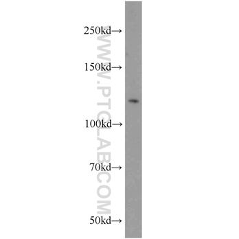 NCKAP1 Rabbit Polyclonal Antibody (12140-1-AP)