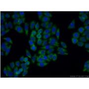 BMP7 Rabbit Polyclonal Antibody (12221-1-AP)
