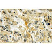 PMP2 Rabbit Polyclonal Antibody (12717-1-AP)