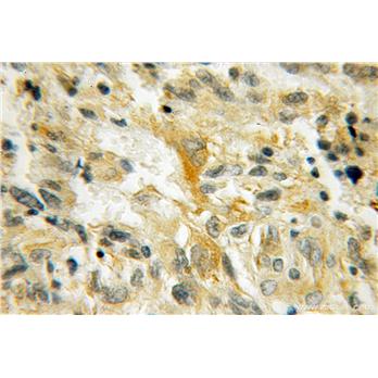 PMP2 Rabbit Polyclonal Antibody (12717-1-AP)